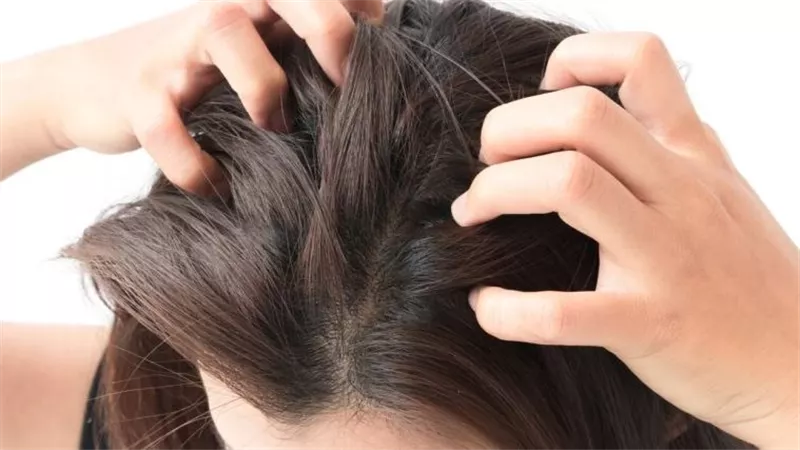 التهاب بصيلات الشعر في فروة الرأس.. الأسباب والأعراض والعلاج