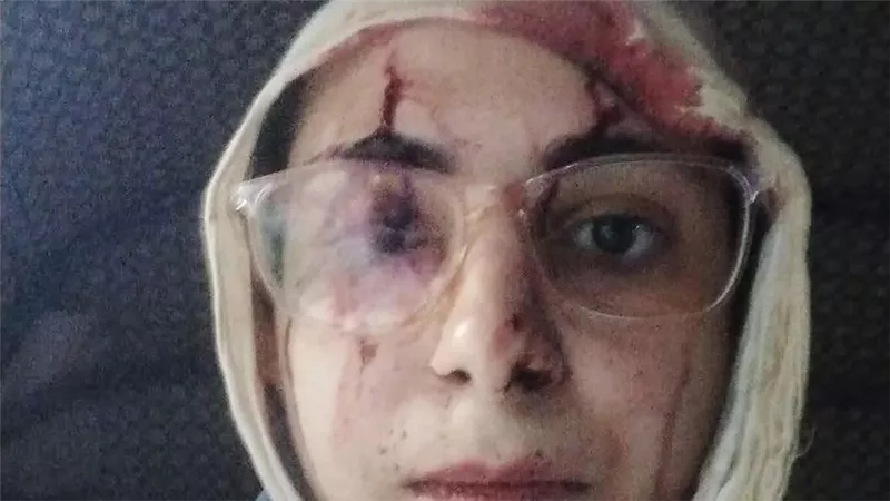 سيدة تستغيث بسبب ضرب زوجها .. 