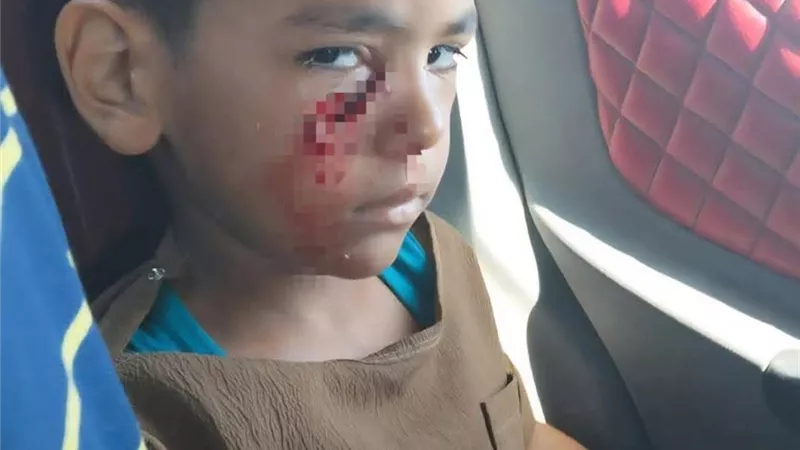 بينهم أطفال.. كلب ضال يعقر 12 شخصا بمدينة السلام بالسويس