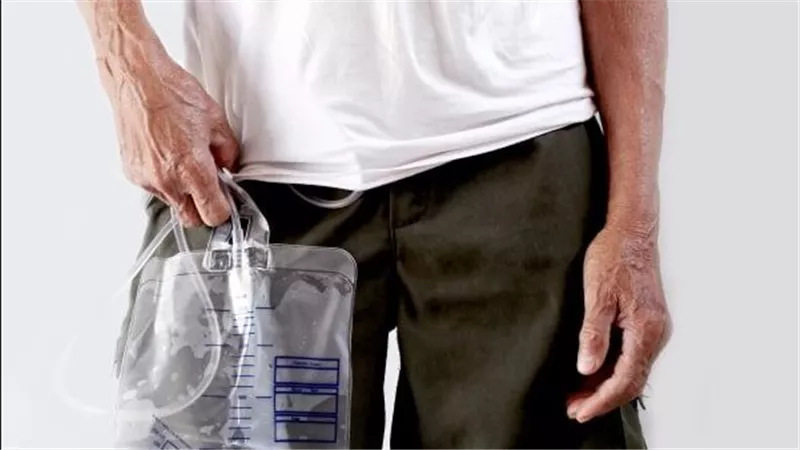 ما حكم صلاة المريض الذي يحمل نجاسة في كيس؟.. الإفتاء تجيب
