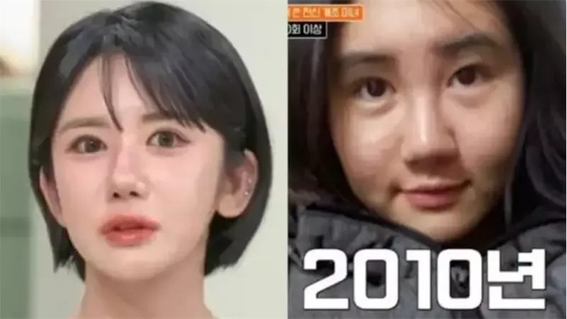 امرأة تنفق أكثر من 200 ألف دولار على 400 عملية تجميل