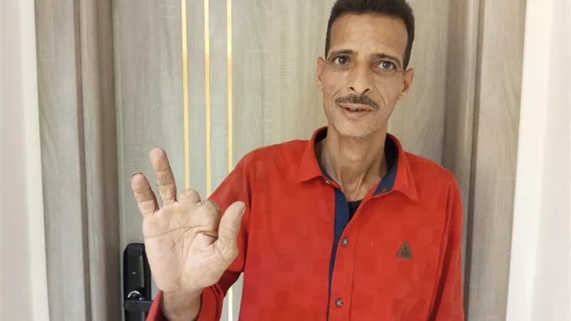 استغاثة حارس عقار من ذوي الهمم: قالولي اقطع صوابعي عشان أجدد الكارنية