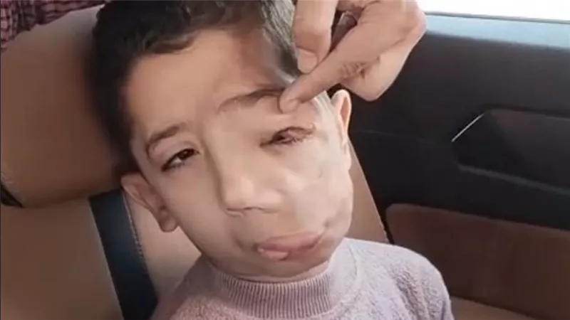«ابني شاف كتير».. أب يناشد الرئيس السيسي لإنقاذ طفله من ورم نادر