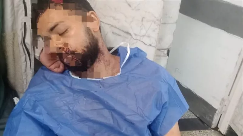 إصابة شاب بجروح قطعية بعد مشادة بسبب معاكسة خطيبته.. وأسرته تطالب بضبط الجاني