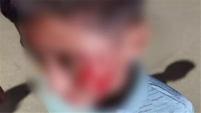كلب شرس يلتهم وجه طفل بمنطقة الهضبة الوسطي بالمقطم 