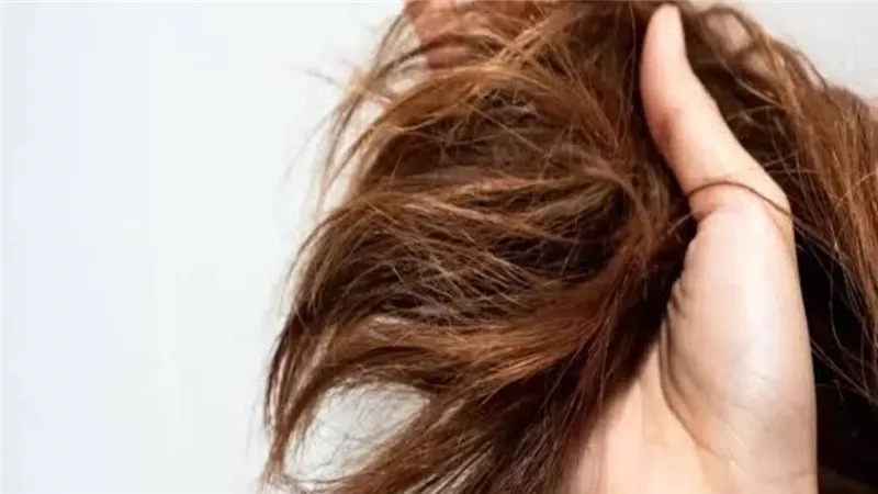 أدوية إنقاص الوزن قد ترتبط بتساقط الشعر المؤقت..دراسة حديثة تكشف التفاصيل