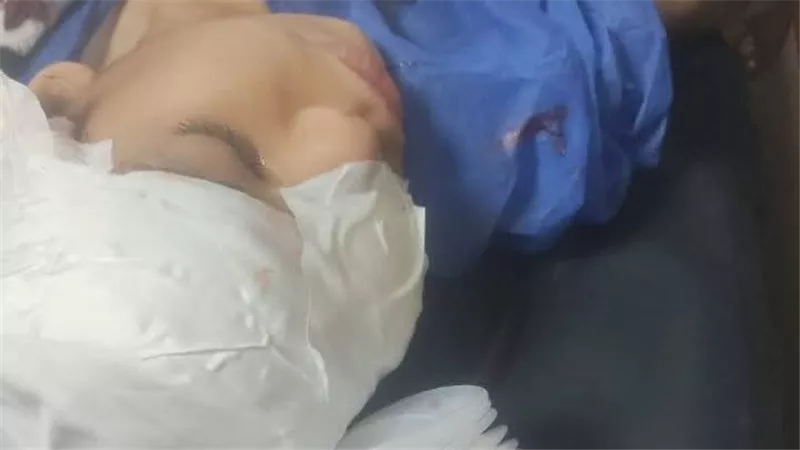 بسبب قذف قطار أشمون بالحجارة.. طفلة تتعرض لنزيف حاد بالمخ بالمنوفية