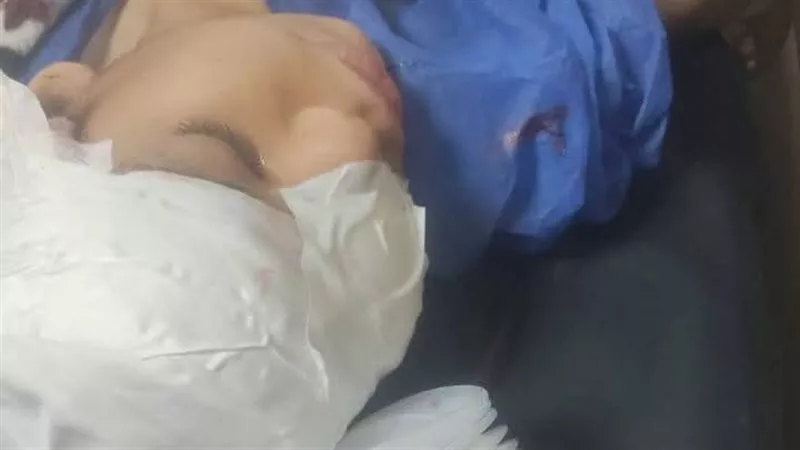 مجلس الوزراء يتدخل لإنقاذ الطفلة ضحية الرشق بالحجارة في قطار أشمون