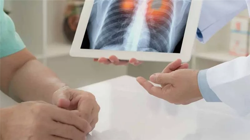 اختراق طبي: تقنية جديدة لإعادة فعالية العلاج الكيميائي ضد خلايا سرطان الرئة