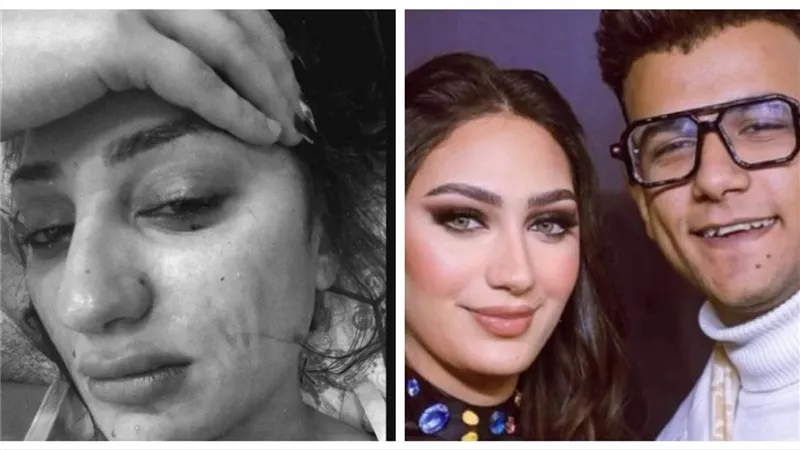 هل الضرب سبب الطلاق.. جهاد طليقة عصام صاصا تثير الجدل بصورة بعد طلاقها
