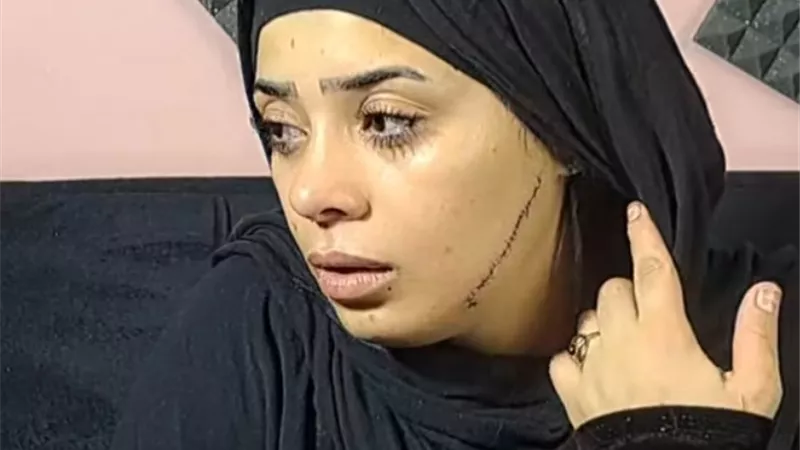 المتهمة بتشويه وجه عروس طليقها فى مصر القديمة تستأنف على حبسها عامين