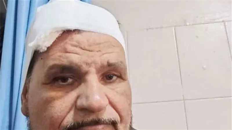 صدمته سيارة مجهولة.. إصابة مرشح بالمنوفية خلال سيره بالدائرة