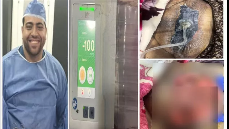 مستشفى دمياط العام يحقق طفرة علاجية بجهاز الفاكيوم للجروح المعقدة