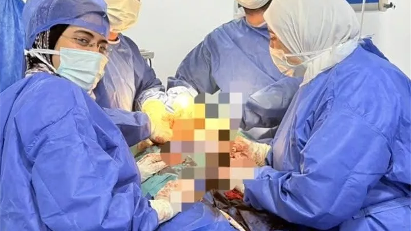 فريق طبي بالبحيرة ينجح في استئصال الرحم والمبيضين لسيدة دون مضاعفات