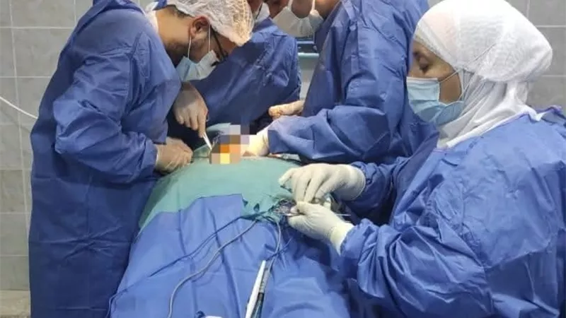 مستشفى رشيد المركزي تنجح فى إجراء جراحتين متقدمتين لحالتين سمنة مفرطة