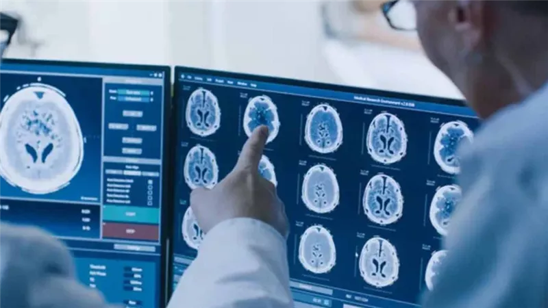طريقة مبتكرة بالذكاء الاصطناعي تكشف المحفزات الخفية للسرطان