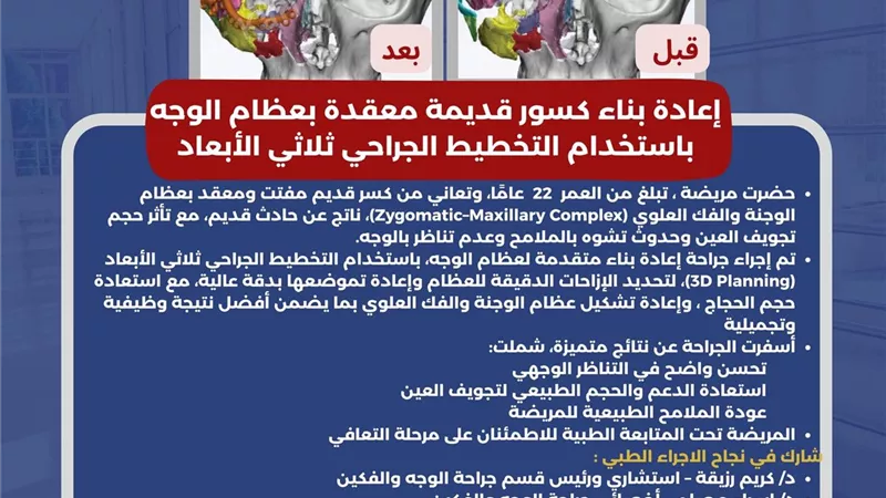 إجراء اول عمليه دقيقة بالوجه والفكين بمستشفى العامرية المركزي 