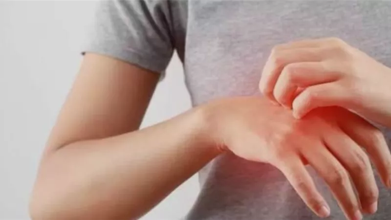 حكة ليلية بلا طفح جلدي؟ أسباب خفية قد تحرمك من النوم 	
