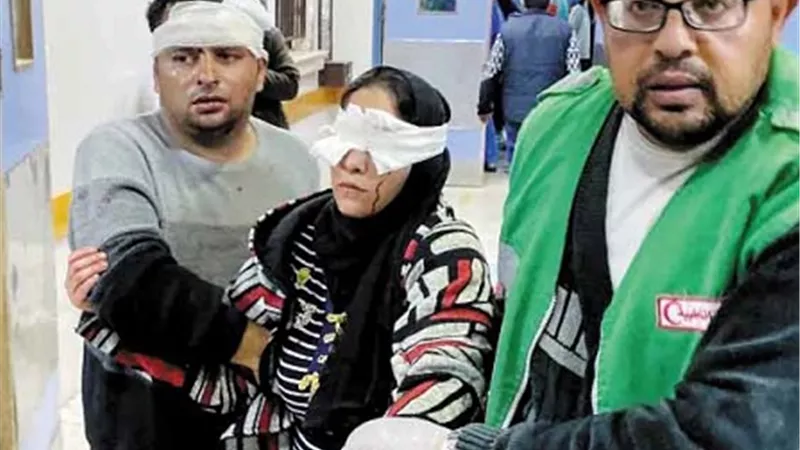 مركزغزة لحقوق الإنسان: أكثر من 1700 فلسطيني فقدوا أعينهم خلال حرب الإبادة 