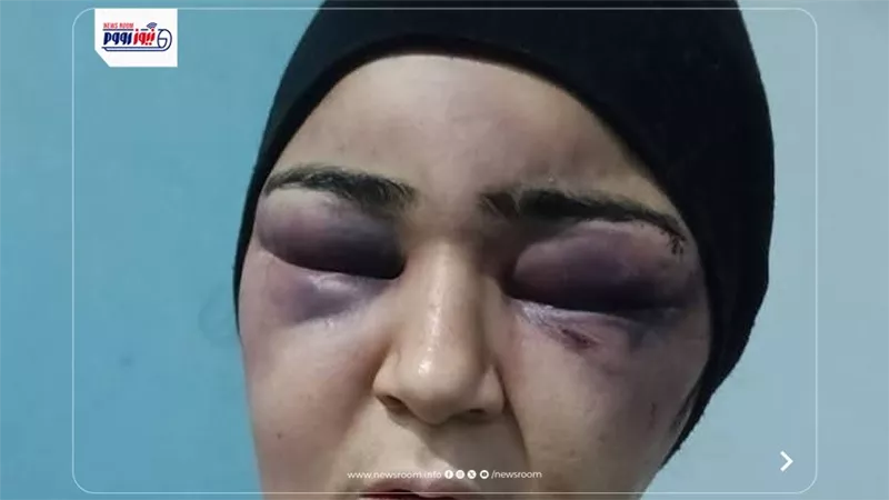 إصابات بالغة بالوجه واليدين.. زوج يعتدي بالضرب على زوجته بالفيوم