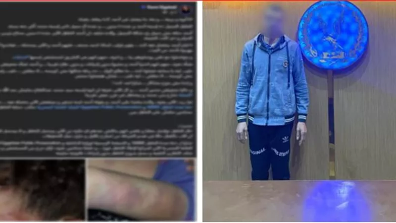 كنت بأدبه..ضبط أب تعدى على نجله بالضرب وتسبب فى إصابته