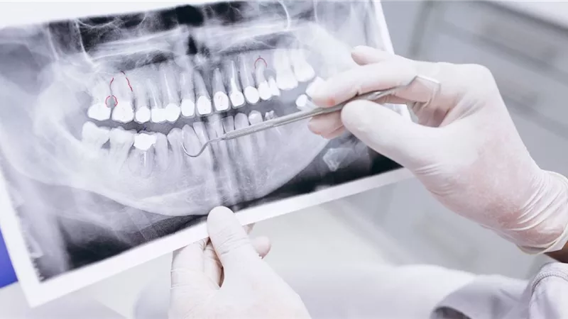نقيب الأسنان يكشف أسباب بطالة الخريجين وسوء توزيع الأطباء