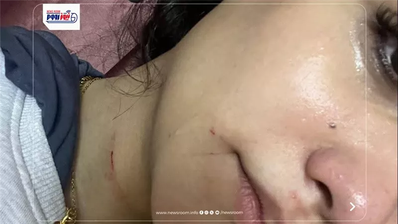 بعد نشر نيوز رووم لاستغاثتها.. القبض علي المتهم بتشويه وجه فتاة بالمعادي