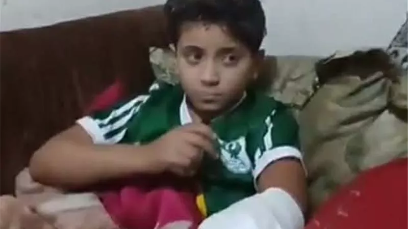 كلب شرس يعقر طفلًا في الإسراء ببورسعيد.. وشقيقته: ذراعه معرض للبتر (صور)