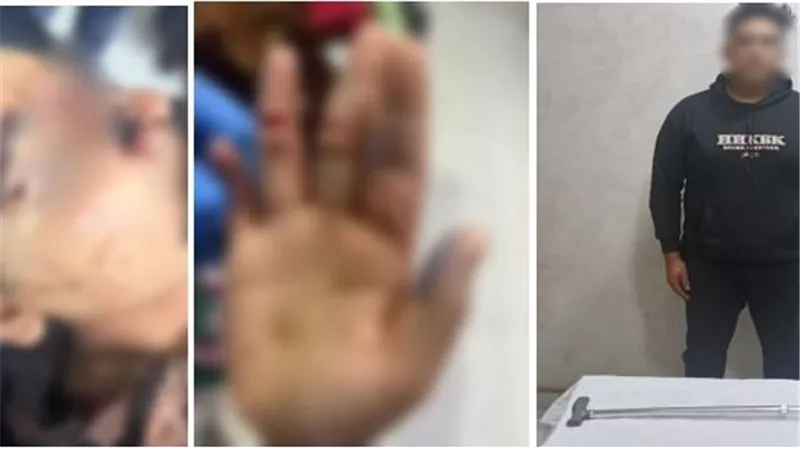 لرفض شقيقها خروجها دون علمه.. الأمن يكشف حقيقة فيديو فتاة مصابة بجروح بالشرقية