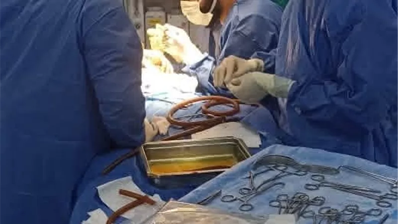 صحة البحيرة نجاح الفريق الطبي فى إجراء عمليتين متقدمتين لطفل وطفلة 