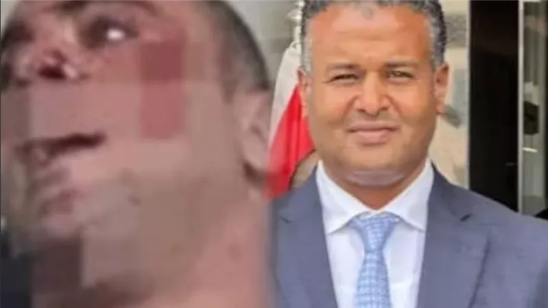 بدء أولى جلسات محاكمة المتهم بالاعتداء على «الديزل» بالشيخ زايد
