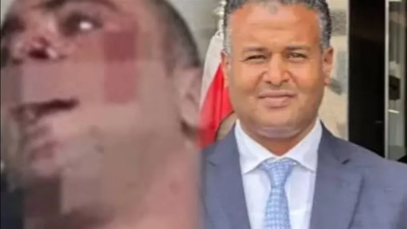 اليوم.. أولى جلسات محاكمة المتهم بالاعتداء على «الديزل» بالشيخ زايد