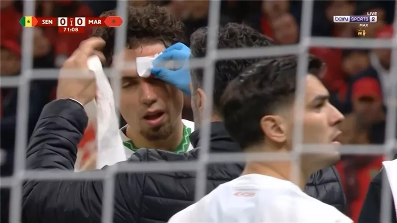 المغرب والسنغال.. إصابة دموية لنيل العيناوي بنهائي كأس الأمم الأفريقية 2025