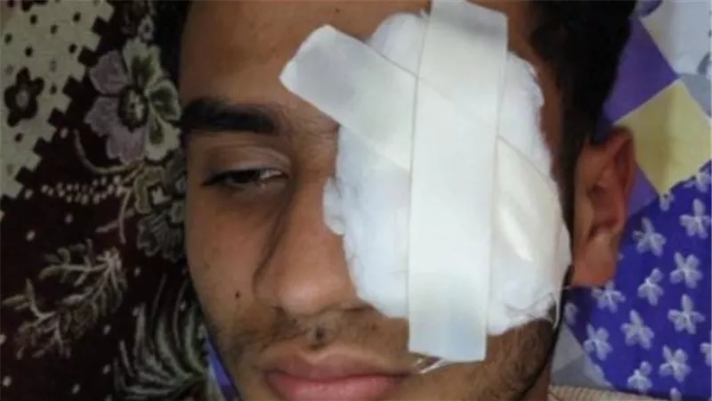 السجن المشدد 10 سنوات لـكوارشي بعد فقد شاب إحدى عينيه في اعتداء عنيف
