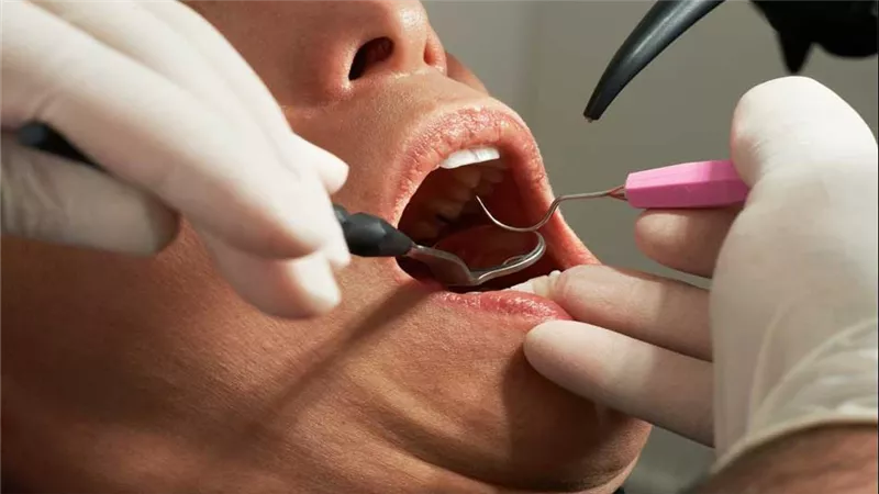لمن يحرص على أيام شهر شعبان.. ما حكم حشو الأسنان أثناء الصيام؟