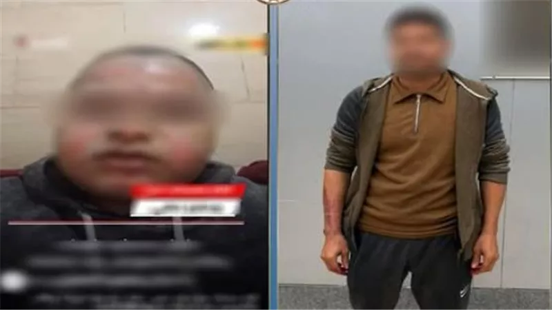 القبض علي صاحب محل حلويات رفض تحمل تكاليف علاج العامل بعد إصابته بالحروق