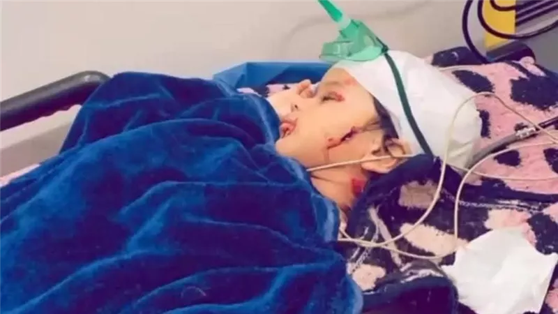 نهش رأسه.. كلب ضال يعقر صغيرا عمره 3 سنوات بمدينة رأس سدر في جنوب سيناء