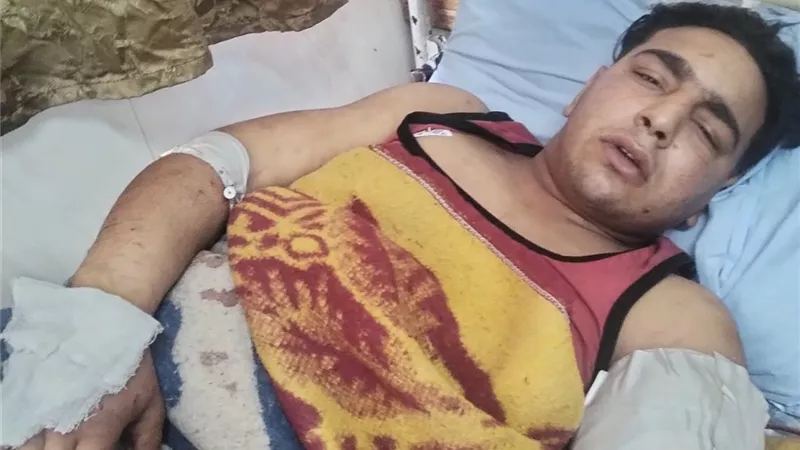 لجنة بيطرية من القاهرة تفحص حيوانات سيرك طنطا بعد واقعة افتراس عامل
