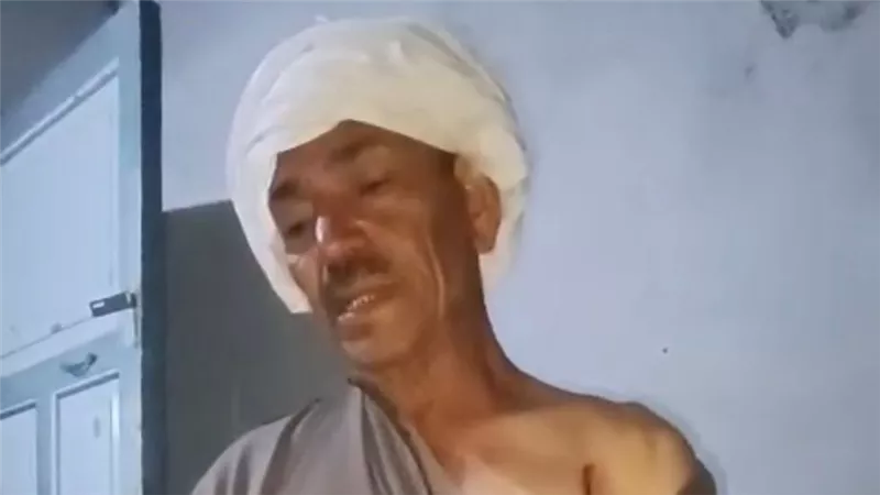 ذئب مفترس يهاجم مزارعًا ستينيًا جنوب الأقصر ويتسبب في إصابات بالغة