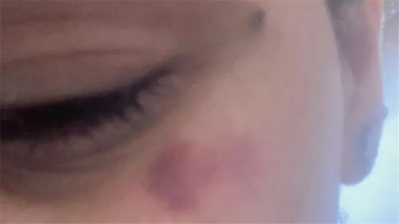 ضرب وسحل وصور خاصة.. مأساة فتاة دمرت حياتها بـ3 قروض من أجل حبيب غدار (تفاصيل)