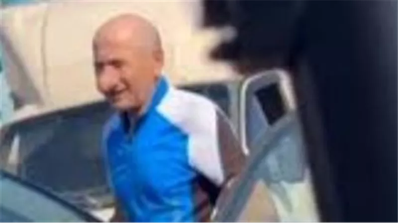 بعد حادث بسيط في الشارع.. أنف رجل روسي يثير دهشة المارة 