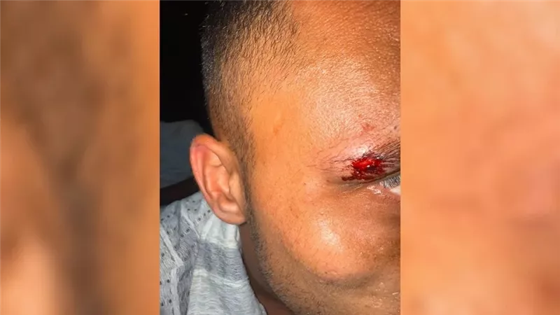 هجوم على سياح إسرائيليين في جزيرة كو ساموي بتايلاند من قبل فرنسيين