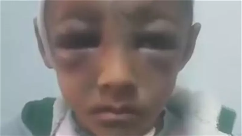 10 جنيهات تتسبب فى تعذيب طفل من والده  في  المحلة بمحافظة الغربية 