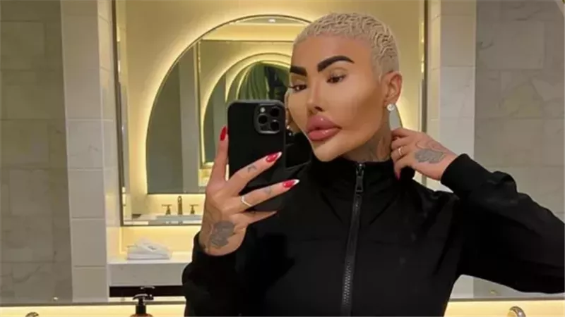 وفاة مؤثر بريطاني بعد إجراء عملية تجميلية ليشبه كيم كارداشيان