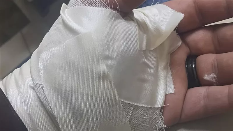 بسبب الخلاف على الأجرة سائق يتعدى على محامى ويصيبه بجرح قطعى بالمنيب