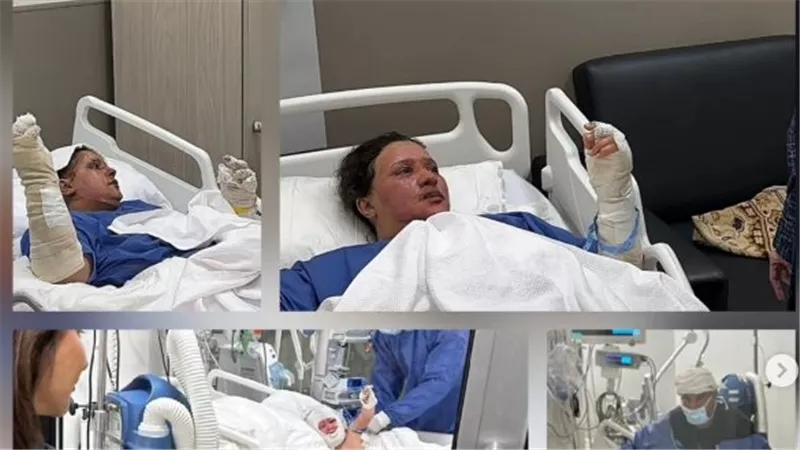 هبة السويدي تحذر من خطورة انفجار أنابيب البوتاجاز على الأطفال: «جلدهم أضعف»