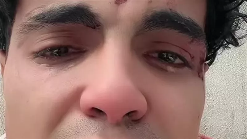 فيديو مؤثر.. صانع محتوى يطالب بحقه بعد الاعتداء عليه من 10 أشخاص|شاهد 