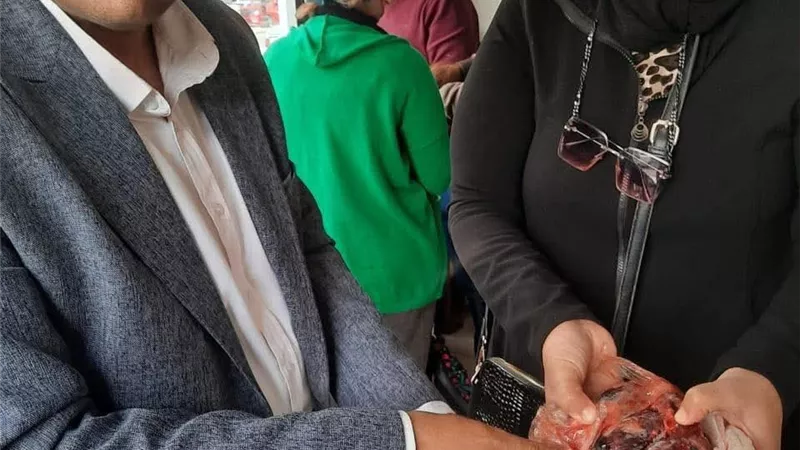 تحرير 144 محضرا وضبط سلع غذائية فاسدة خلال حملات تموينية مكثفة بالسويس