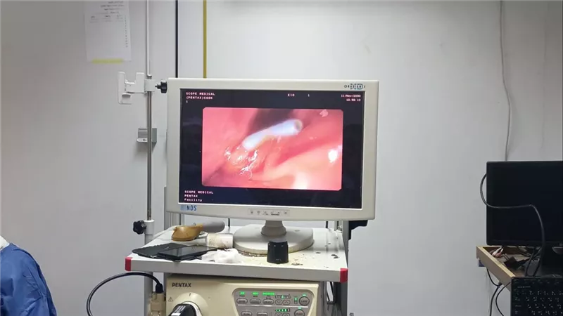 فريق طبي بحميات قنا ينقذ مريض من انسداد حاد بالقنوات المرارية