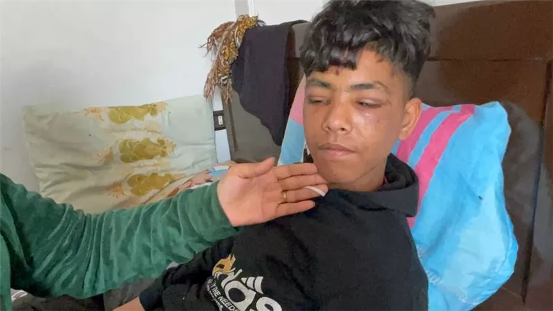 مواطن بالمنوفية يطفأ السجائر فى وجه طفل بعد مشاجرة مع نجله 